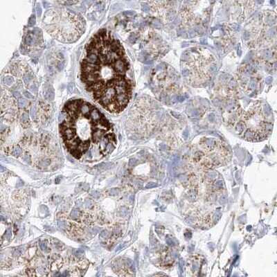 Immunohistochemistry-Paraffin: PCCB Antibody [NBP1-85886]