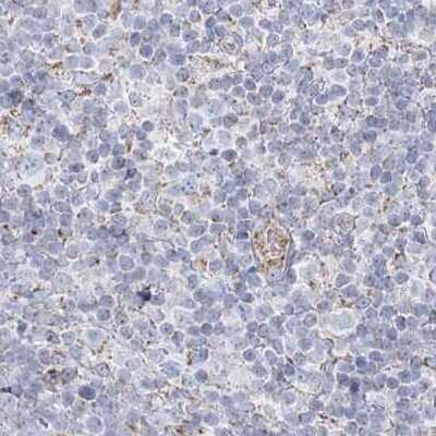 Immunohistochemistry-Paraffin: PCCB Antibody [NBP1-85886]