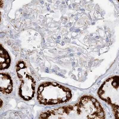 Immunohistochemistry-Paraffin: PCCB Antibody [NBP1-85886]