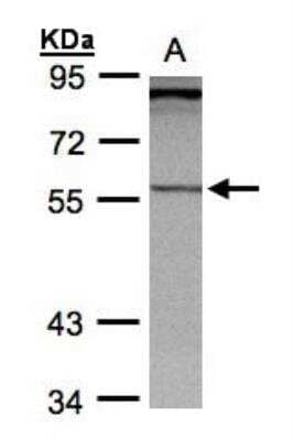 Western Blot: PCCB Antibody [NBP1-31464]