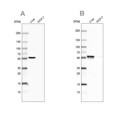 Western Blot: PCCB Antibody [NBP1-85887]