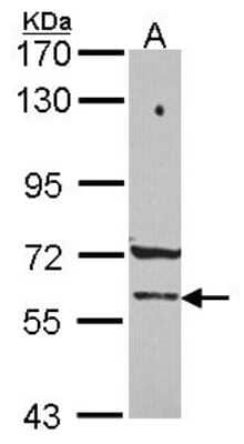 Western Blot: PCCB Antibody [NBP2-19718]