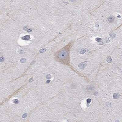 Immunohistochemistry-Paraffin: PCDH11 Antibody [NBP3-17750]