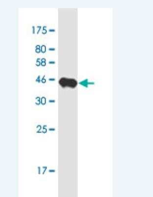 Western Blot: PCDH11 Antibody (7B4) [H00027328-M05-50ug]