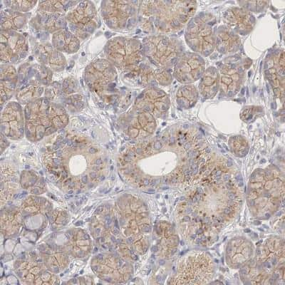 Immunohistochemistry-Paraffin: PCDH11 Antibody [NBP1-80939]