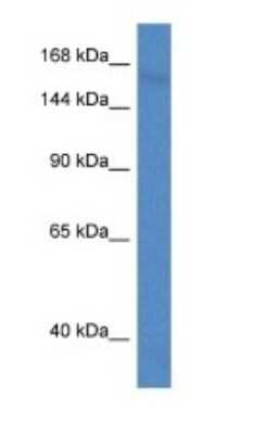 Western Blot: PCDH11 Antibody [NBP1-79198]