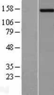 Western Blot: PCDH11Y Overexpression Lysate [NBL1-14149]