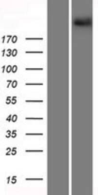 Western Blot: Protocadherin-15 Overexpression Lysate [NBP2-09670]