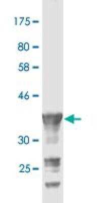 Western Blot: PCDH20 Antibody (1B7) [H00064881-M02]