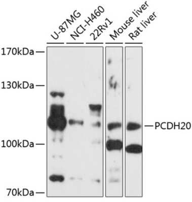 Western Blot: PCDH20 AntibodyBSA Free [NBP2-93484]