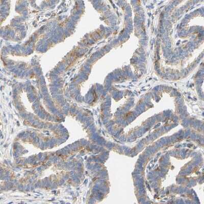 Immunohistochemistry-Paraffin: PCDH7 Antibody [NBP1-88610]