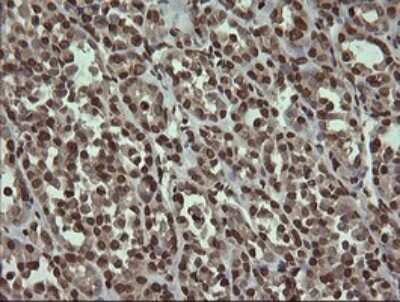 Immunohistochemistry: PCDH7 Antibody (OTI1F7) [NBP2-46340]