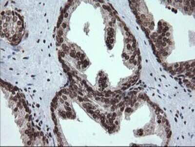 Immunohistochemistry: PCDH7 Antibody (OTI1F7) [NBP2-46340]