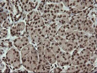 Immunohistochemistry: PCDH7 Antibody (OTI1F7) [NBP2-46340]