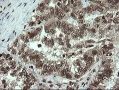 Immunohistochemistry: PCDH7 Antibody (OTI1F7) [NBP2-46340]