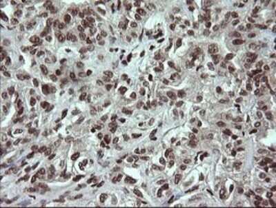 Immunohistochemistry: PCDH7 Antibody (OTI1F7) [NBP2-46340]