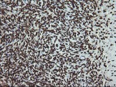 Immunohistochemistry: PCDH7 Antibody (OTI1F7) [NBP2-46340]