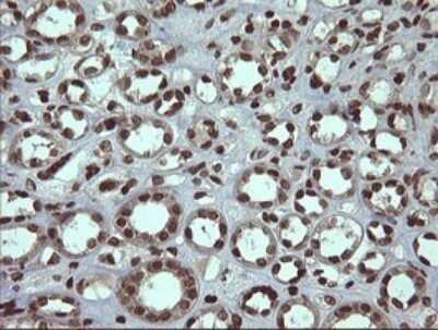 Immunohistochemistry: PCDH7 Antibody (OTI1F7) [NBP2-46340]