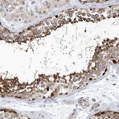 Immunohistochemistry-Paraffin: PCDHA2 Antibody [NBP1-86302]