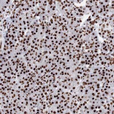 Immunohistochemistry-Paraffin: PCDHA3 Antibody [NBP1-87323]