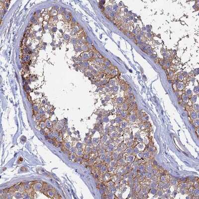 Immunohistochemistry-Paraffin: PCDHA5 Antibody [NBP1-92244]