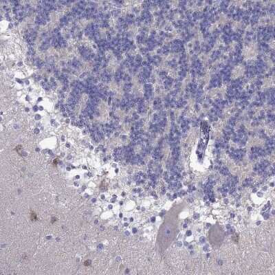 Immunohistochemistry: PCDHA6 Antibody [NBP2-69060]