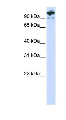 Western Blot: PCDHA6 Antibody [NBP1-59262]