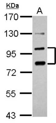 Western Blot: PCDHA6 Antibody [NBP2-19725]