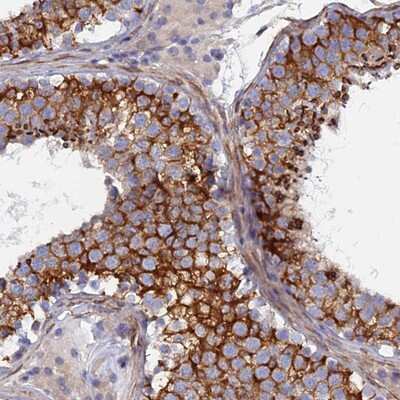 Immunohistochemistry-Paraffin: PCDHA8 Antibody [NBP1-86195]