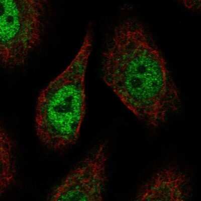 Immunocytochemistry/ Immunofluorescence: PCDHAC2 Antibody [NBP2-56046]