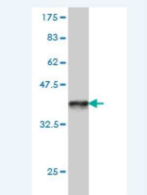 Western Blot: PCDHB14 Antibody (5F7) [H00056122-M01]