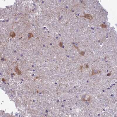 Immunohistochemistry-Paraffin: PCDHB14 Antibody [NBP1-92245]