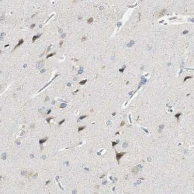 Immunohistochemistry-Paraffin: PCDHB15 Antibody [NBP1-87322]