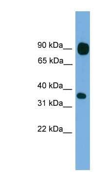 Western Blot: PCDHB15 Antibody [NBP1-56997]