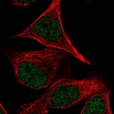 Immunocytochemistry/ Immunofluorescence: PCDHB2 Antibody [NBP2-30922]