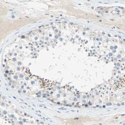 Immunohistochemistry-Paraffin: PCDHB2 Antibody [NBP2-30922]