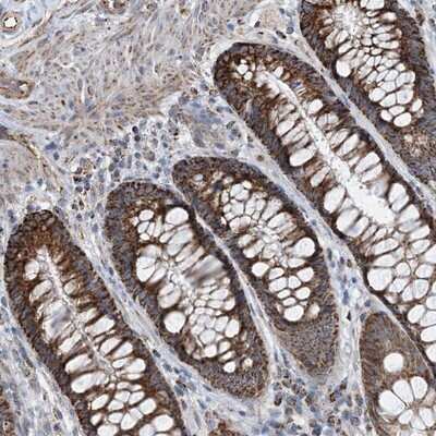 Immunohistochemistry-Paraffin: PCDHGA1 Antibody [NBP1-80940]