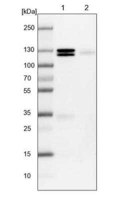 Western Blot: PCDHGA2 Antibody [NBP2-54658]