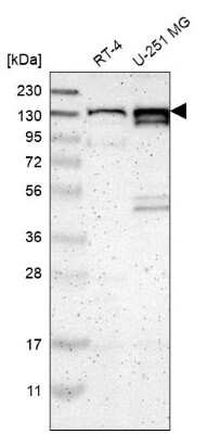 Western Blot: PCDHGA2 Antibody [NBP2-68580]