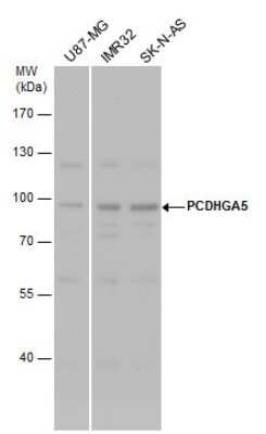 Western Blot: PCDHGA5 Antibody [NBP2-43756]