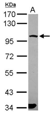 Western Blot: PCDHGA6 Antibody [NBP2-15064]