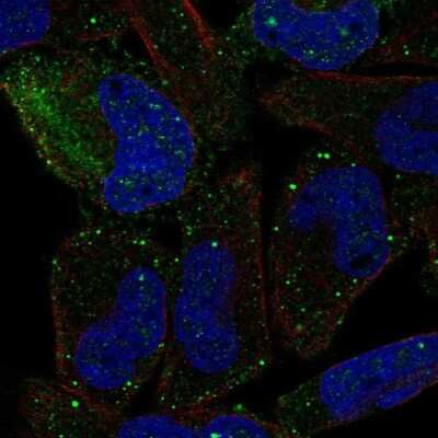 Immunocytochemistry/ Immunofluorescence: PCDHGB2 Antibody [NBP2-69043]