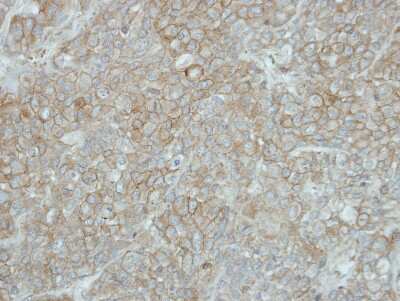Immunohistochemistry-Paraffin: PCDHGB5 Antibody [NBP2-15066]