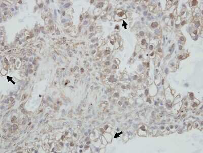 Immunohistochemistry-Paraffin: PCDHGC4 Antibody [NBP2-19728]