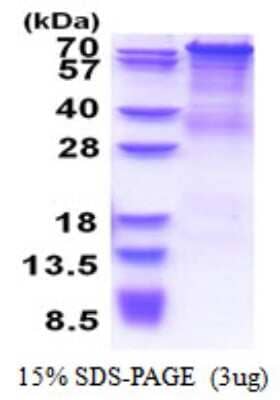 SDS-PAGE: Recombinant Human PCDHGC4 His Protein [NBP2-51537]