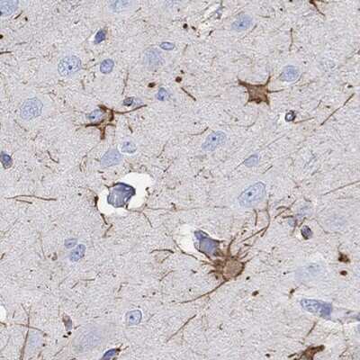 Immunohistochemistry-Paraffin: PCDHGC5 Antibody [NBP3-17906]