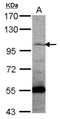 Western Blot: PCDHGC5 Antibody [NBP2-15067]