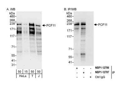 Western Blot: PCF11 Antibody [NBP2-12787]