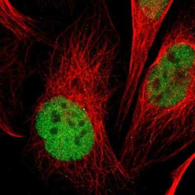 Immunocytochemistry/ Immunofluorescence: PCGF1 Antibody [NBP1-82767]