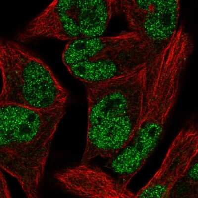 Immunocytochemistry/ Immunofluorescence: PCGF1 Antibody [NBP2-55951]